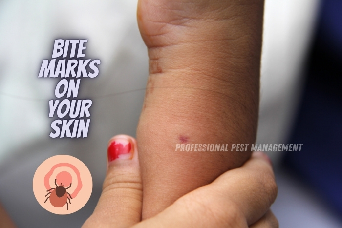 Understanding these signs is crucial for homeowners in Chennai to identify pest infestations and seek timely pest control solutions